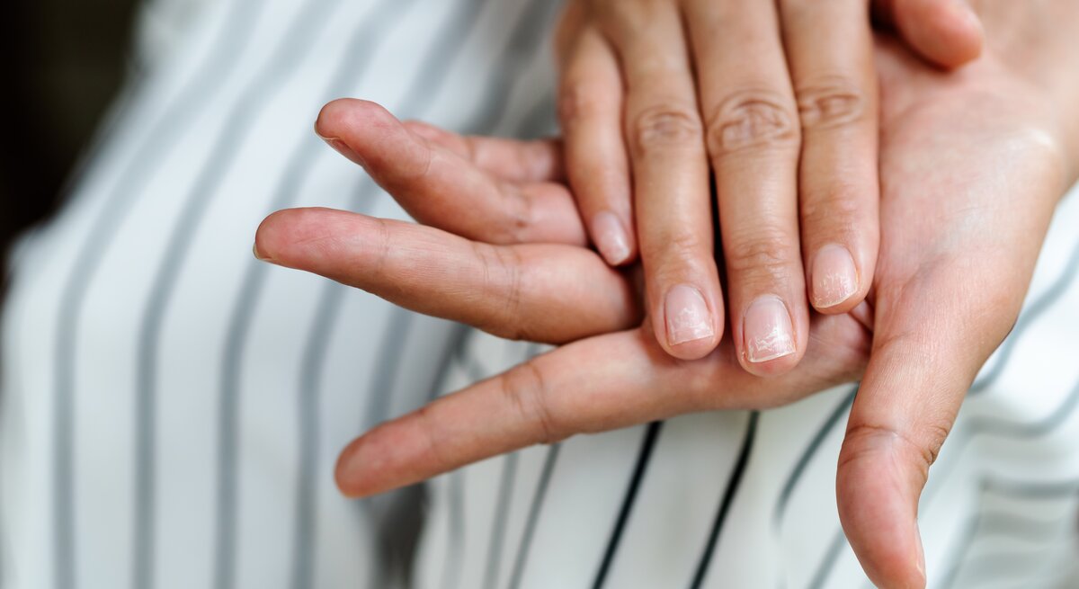 Eine Person präsentiert ihre Fingernägel.