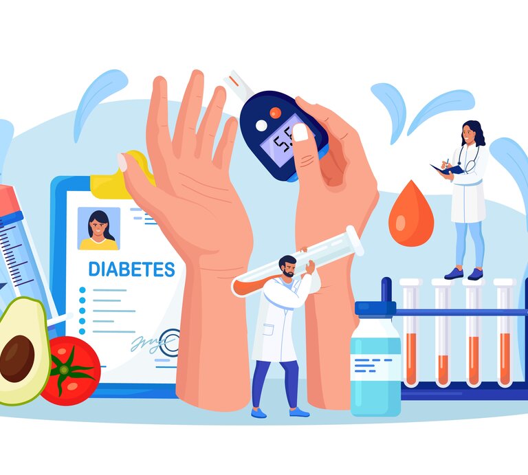 Eine Illustration, die verschiedene Aspekte von Diabetes darstellt. Im Zentrum steht eine große, schützende Hand, die ein Blutzuckermessgerät mit einer Anzeige von 5.0 hält, umgeben von medizinischem Personal und Diabetesbehandlungs-Tools. Links ist ein Arzt zu sehen, der ein Tablet hält, daneben eine große Injektionsspritze und Avocado mit Tomate, symbolisch für gesunde Ernährung. Auf der rechten Seite steht eine Ärztin auf einem Reagenzglasständer neben Blutproben und einer Insulinflasche. Die Szene ist in freundlichen, hellen Farbtönen gehalten, die eine positive Atmosphäre ausstrahlen. | © Shutterstock/Buravleva stock