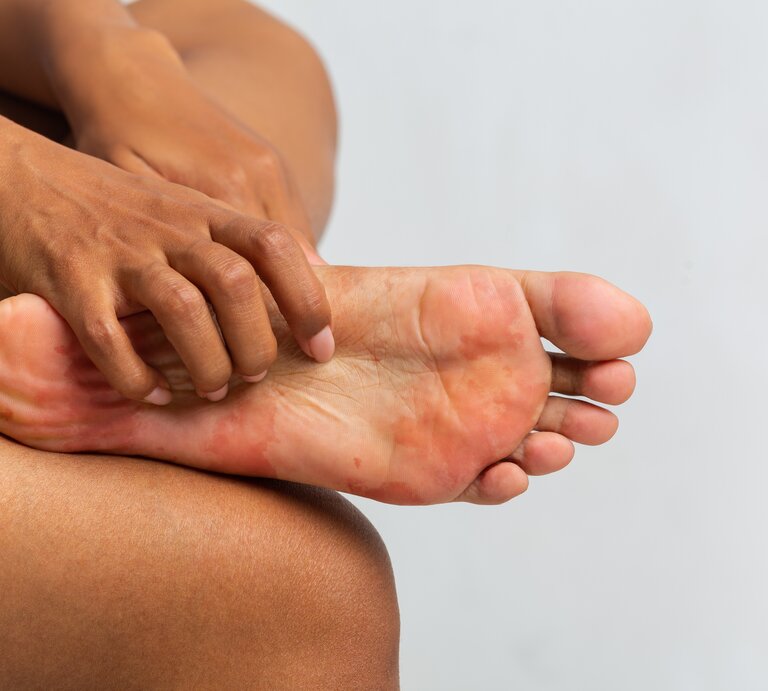 Eine Frau legt ihre Hand auf ihre Fußsohle. | © Getty Images/Prostock-Studio