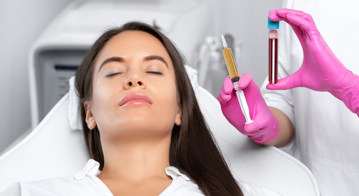Eigenblutbehandlung PRP-Lifting