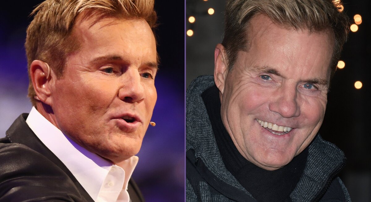 Es sind zwei Bilder von Dieter Bohlen zu sehen. Eins mit Falten, eins mit weniger Falten im Gesicht.