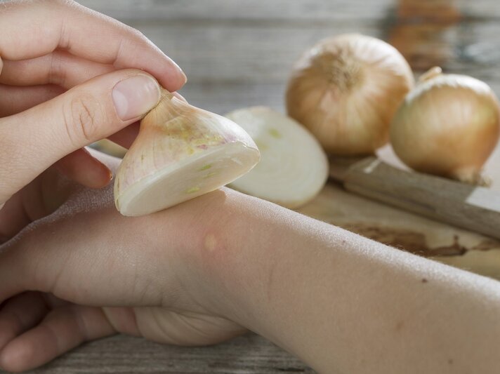 wespezwiebel.jpg | © Imago/blickwinkel