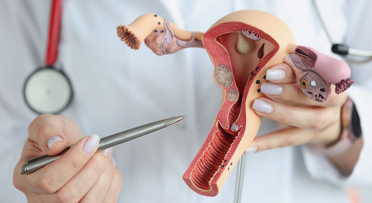 Hand einer Medizinerin zeigt Uterus und Eierstöcke an einem Modell