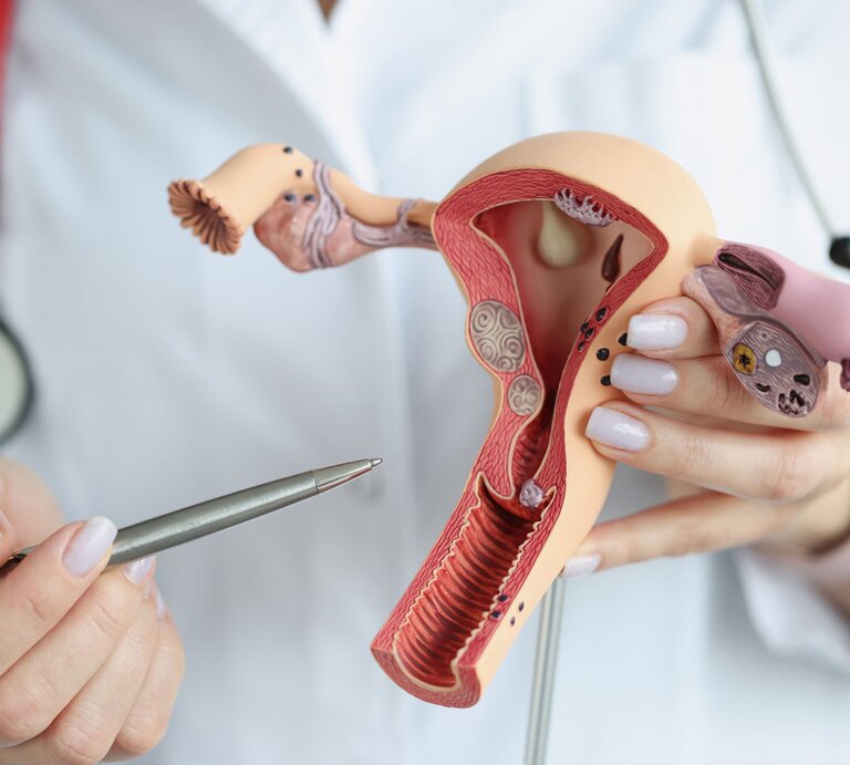 Hand einer Medizinerin zeigt Uterus und Eierstöcke an einem Modell | © Getty Images