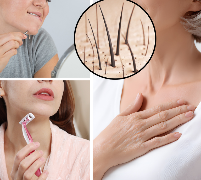 Zwei Frauen entfernen Gesichtshaare mit Pinzette und Rasierer, daneben Nahaufnahme von Haarwuchs und ältere Frau mit Hand auf Brust. | © Canva [M]
