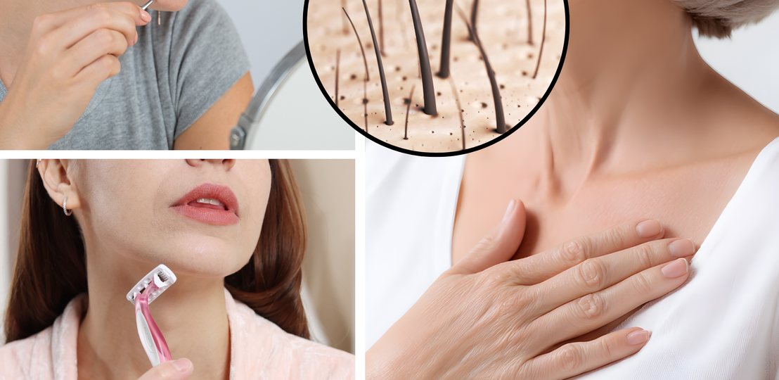 Zwei Frauen entfernen Gesichtshaare mit Pinzette und Rasierer, daneben Nahaufnahme von Haarwuchs und ältere Frau mit Hand auf Brust. | © Canva [M]