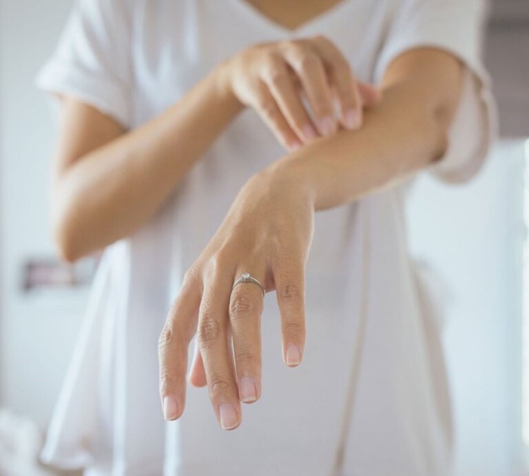  Das Bild zeigt eine Person, die ihren eigenen Unterarm betrachtet und mit der anderen Hand leicht darüber streicht oder kratzt. Das Individuum trägt ein weißes T-Shirt und hat einen Ring am Finger, was darauf hindeuten könnte, dass es sich um eine Frau handelt. Die Aufmerksamkeit auf den Arm und die Geste des Betrachtens oder Kratzens könnten auf Hautprobleme wie Nesselsucht hinweisen, bei der die Betroffenen oft einen Juckreiz oder eine Reizung verspüren.  | © iStock/Piyapong Thongcharoen