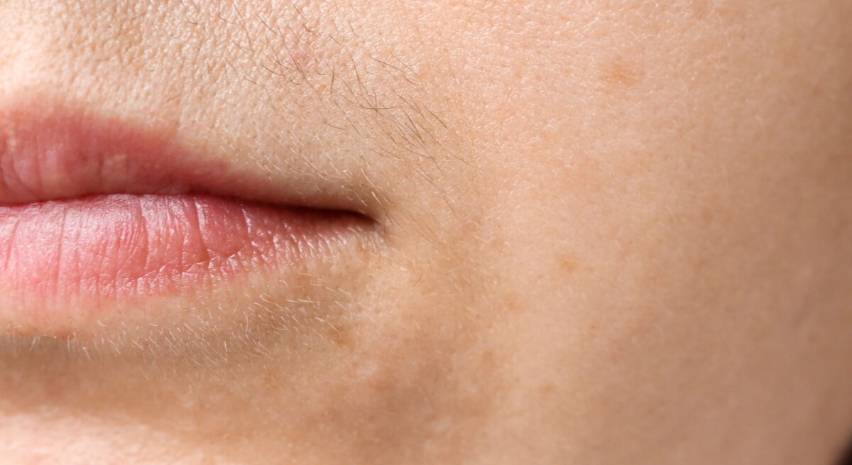 Nahaufnahme des unteren Gesichtsbereichs einer Frau, fokussiert auf die Mundpartie und die Haut darum herum. Die Lippen sind geschlossen und natürlich rosa, und die Haut zeigt Poren und ein paar feine Härchen, wie einen leichten Damenbart, auf der Oberlippe. Es sind auch einige dezente, dunklere Flecken auf der Haut sichtbar, die auf Pigmentierung hinweisen könnten