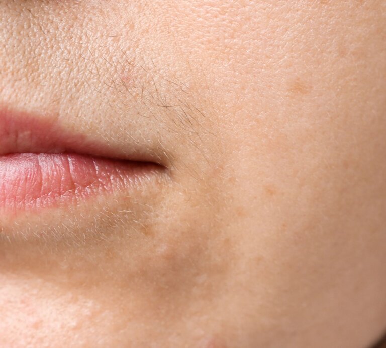 Nahaufnahme des unteren Gesichtsbereichs einer Frau, fokussiert auf die Mundpartie und die Haut darum herum. Die Lippen sind geschlossen und natürlich rosa, und die Haut zeigt Poren und ein paar feine Härchen, wie einen leichten Damenbart, auf der Oberlippe. Es sind auch einige dezente, dunklere Flecken auf der Haut sichtbar, die auf Pigmentierung hinweisen könnten | © Adobe Stock/ Юлия Черкасова
