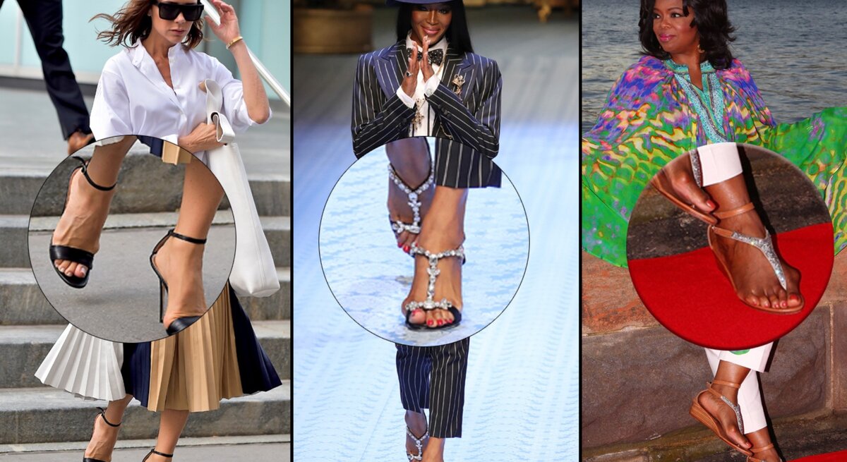 Collage von drei Prominenten, die alle High Heels tragen und möglicherweise unter Hallux valgus leiden. Die Fotos der Prominenten sind in der oberen Hälfte des Bildes zu sehen, während ihre Füße in Vergrößerungen unten hervorgehoben werden.